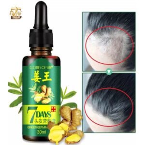 7 Days Ginger Hair Growth Serum – Fast Hair Regrowth Anti Hair Fall Natural Ginger Hair Treatment Oil Pakistan