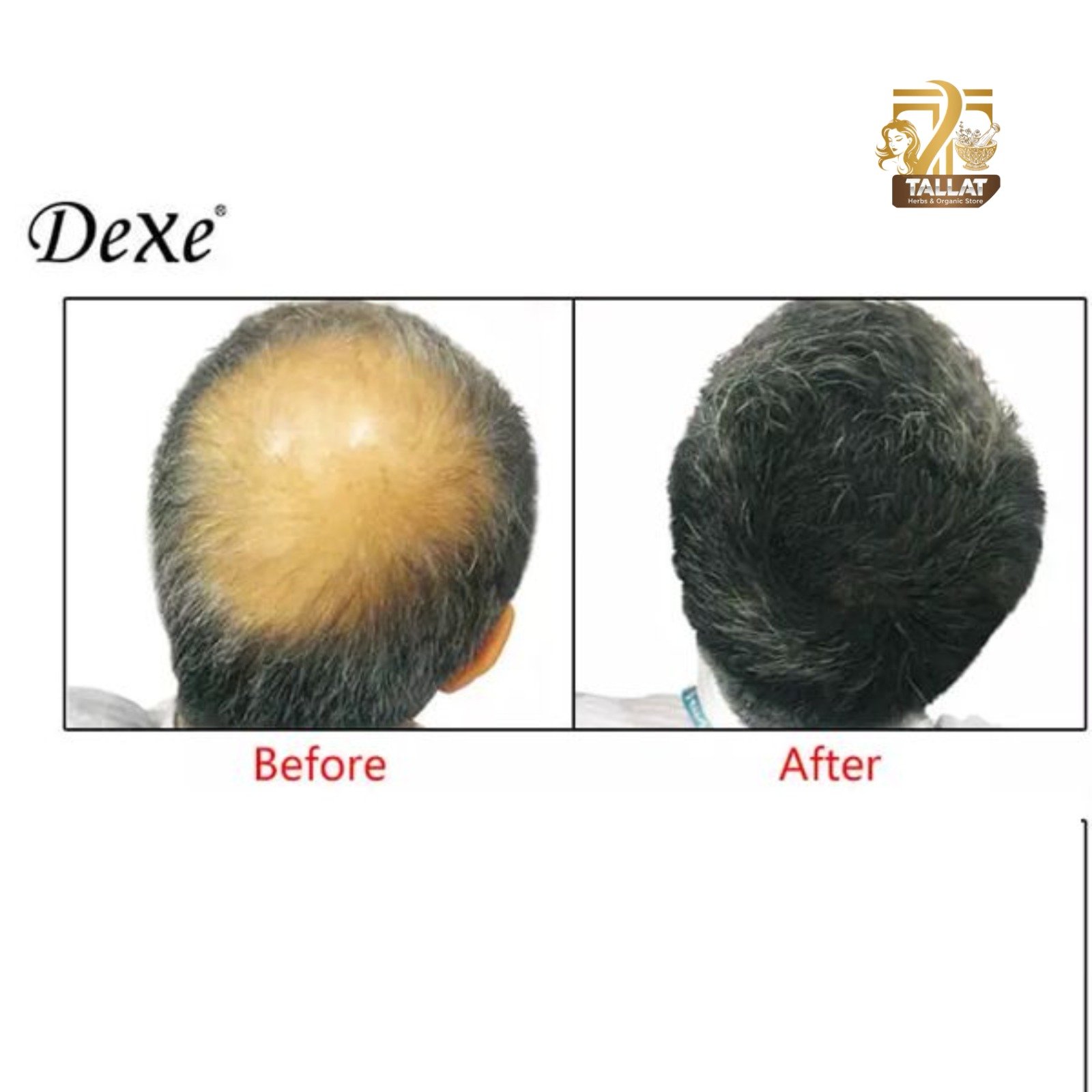 Dexe Hair Building Fibers Black – Instant Bald Spot Concealer Hair Thickening Fiber for Men Pakistan - Image 2