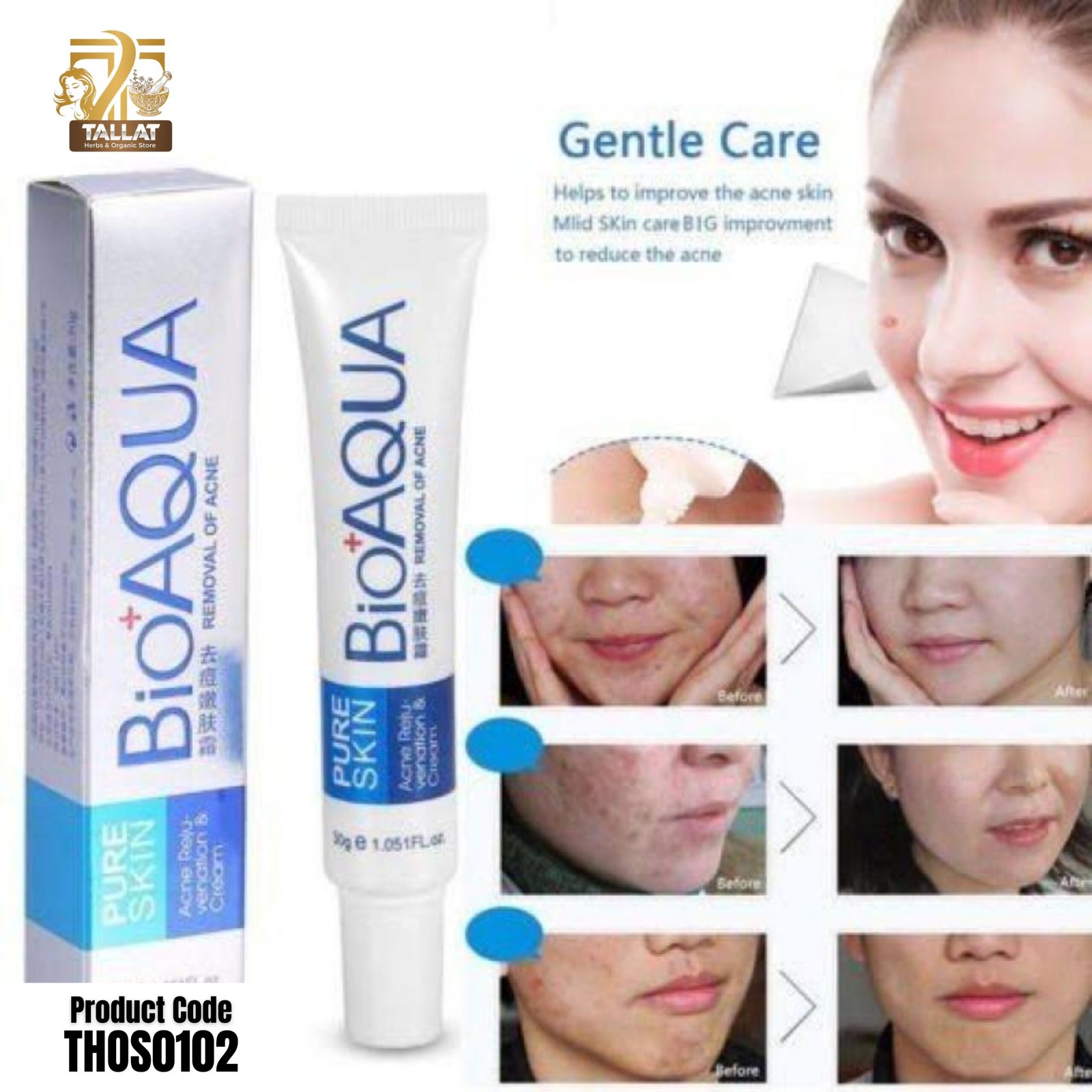Bioaqua Acne Cream 30g – Face Skin Care Cream for Blemishes, Spots & Smooth-Looking Skin - Image 2