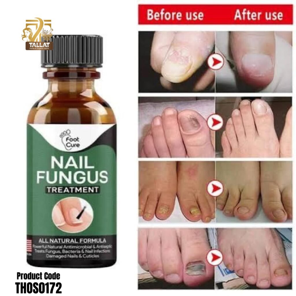 Nail Fungus Treatment 10ml – Effective Fingernail & Toenail Care Solution